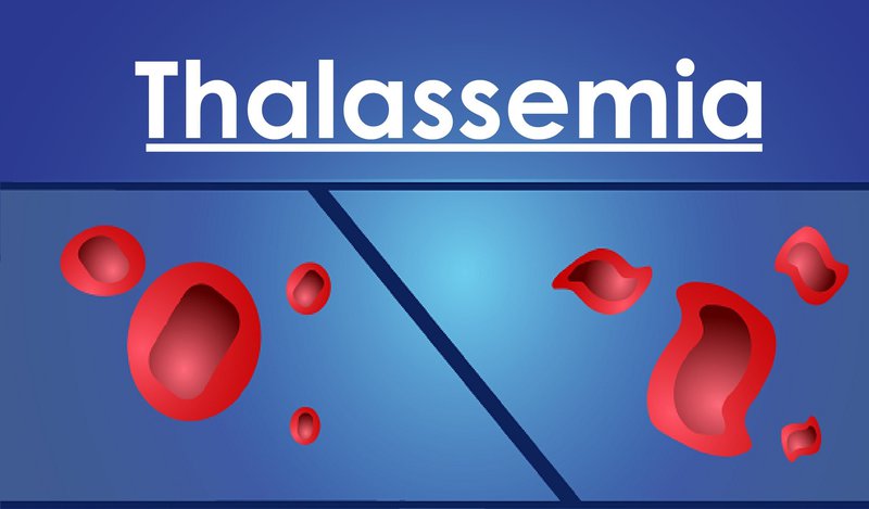 Bệnh thalassemia có ảnh hưởng gì đến cuộc sống hàng ngày của những người bị mắc bệnh?

