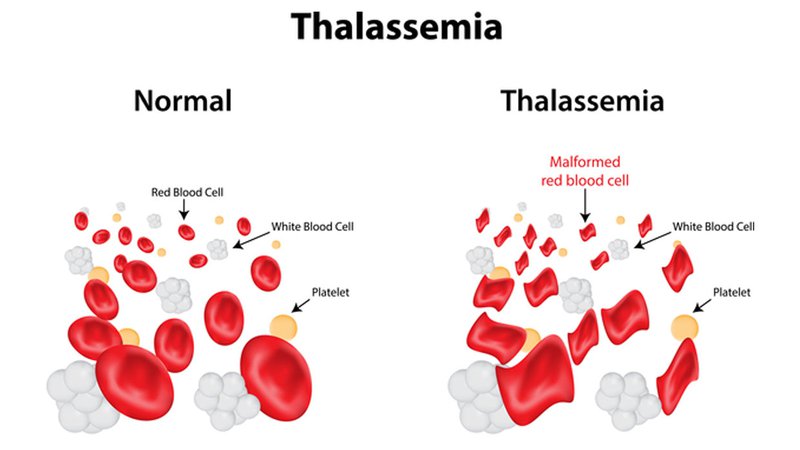 Xét nghiệm thalassemia ở đâu