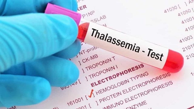 Địa chỉ xét nghiệm thalassemia