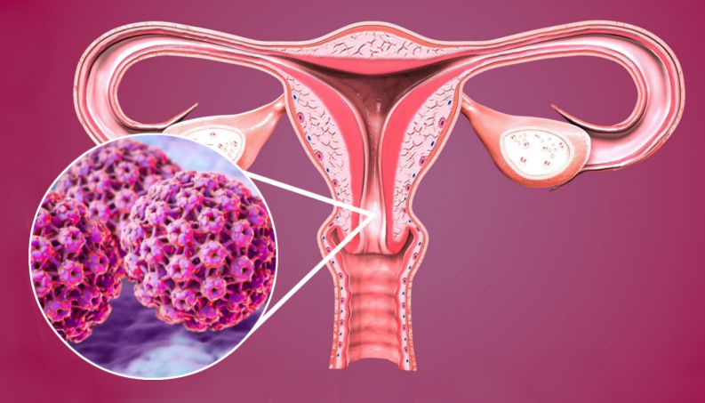 nguyên nhân nhiễm HPV là gì