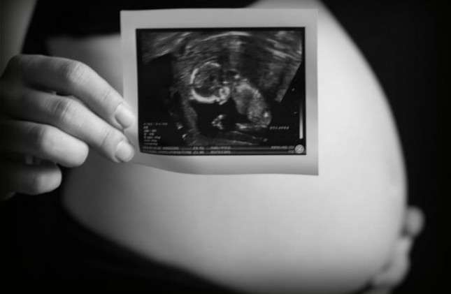 Tìm thấy ADN con trai trong não người mẹ