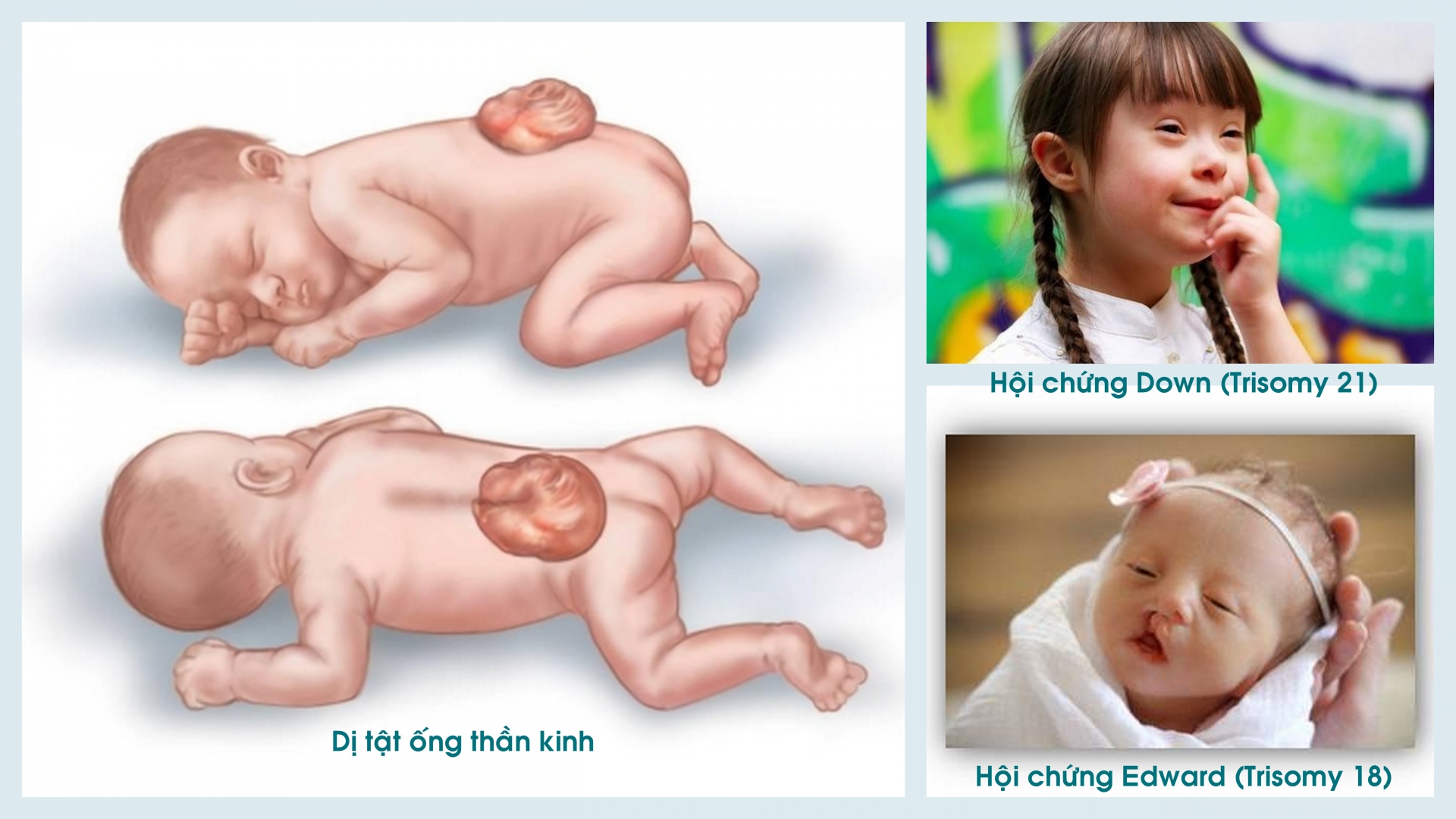 sang-loc-di-tat-thai-nhi2