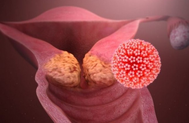 Virus HPV tồn tại trong cơ thể bao lâu?