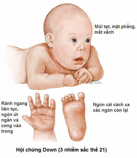 cac-di-tat-thai-nhi-thuong-gap