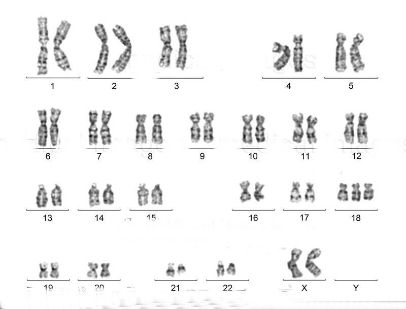 Các dị tật thai nhi thường gặp