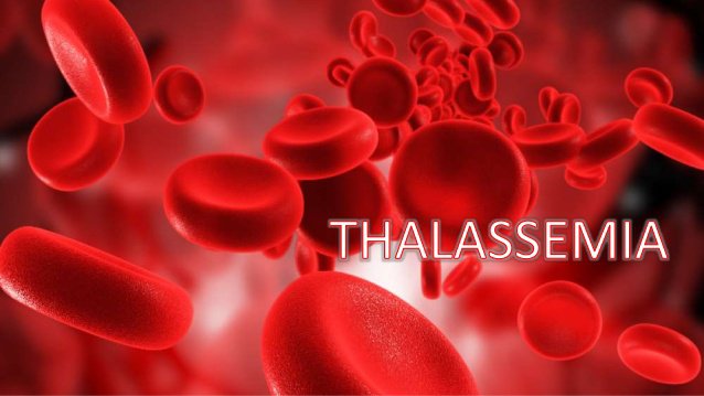 sàng lọc trước sinh giúp phát hiện bệnh gì 2