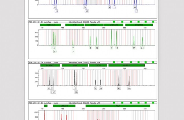 Kết quả xét nghiệm ADN tiết lộ cho bạn điều gì?