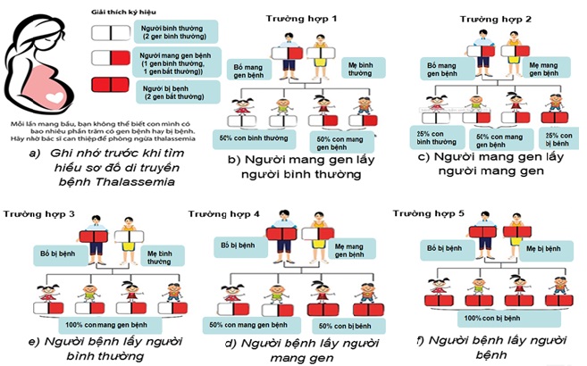 Bệnh Thalassemia Dị Hợp Tử Là Gì - Tìm Hiểu Chi Tiết và Đầy Đủ