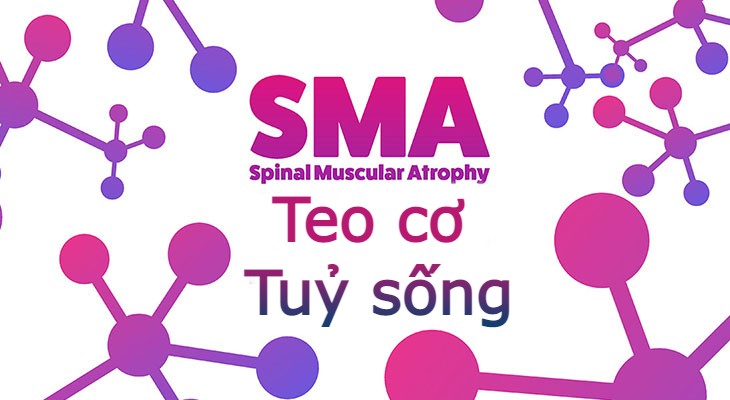 Teo cơ tuỷ sống - bệnh di truyền ít người mắc nhưng nguy hiểm