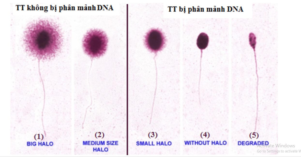 Phương Pháp Giảm Thiểu Đứt Gãy ADN Tinh Trùng