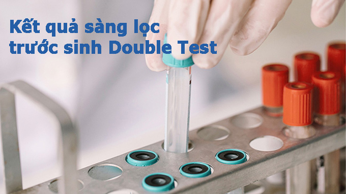 Kết quả Double test báo hiệu điều gì về tình trạng sức khỏe của thai nhi và có cần tiến hành các xét nghiệm khác để xác định chính xác hơn?