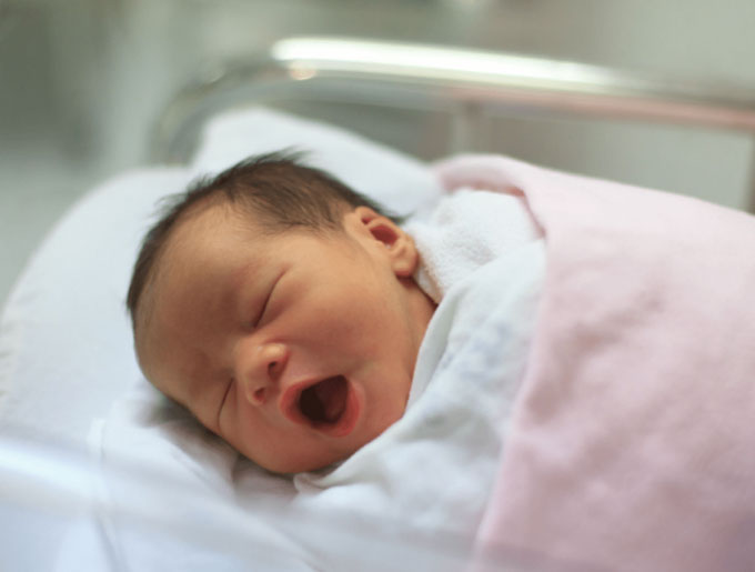 Dị tật thai nhi hội chứng Patau