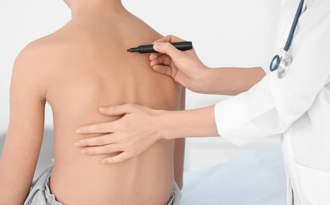 điều trị chứng phì đại lồng ngực