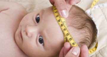 dị tật thai nhi đầu nhỏ