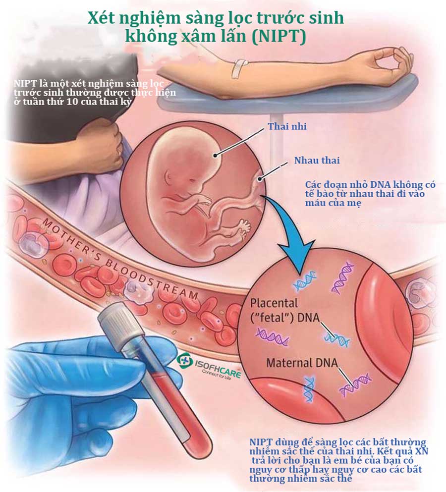 Sàng Lọc Trước Sinh NIPT: Mọi Điều Cần Biết Để Đảm Bảo Sức Khỏe Cho Mẹ Và Bé