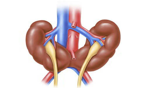 Dị tật thận m&oacute;ng ngựa
