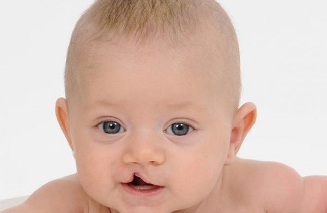 Dị tật bẩm sinh có di truyền không