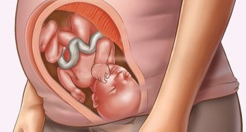 dị tật thai nhi làm sao để ngăn ngừa