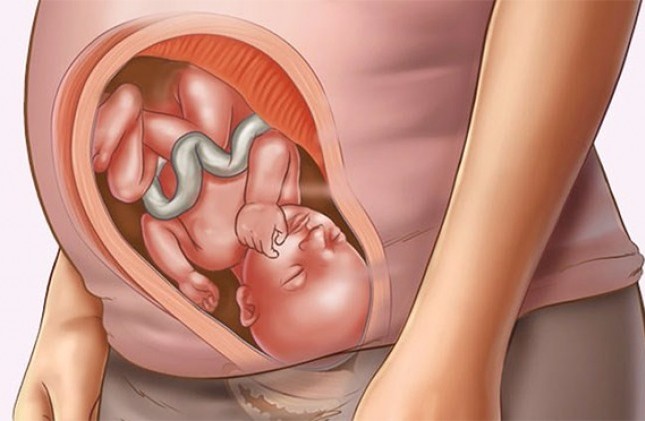 dị tật thai nhi làm sao để ngăn ngừa