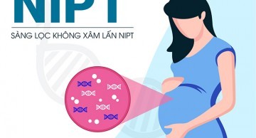 những ai cần làm xét nghiệm NIPT