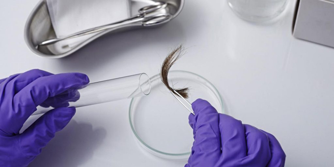 Thử ADN bằng mẫu tóc có chân