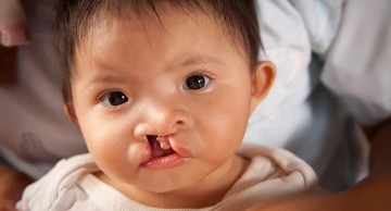 nguy cơ dị tật thai nhi