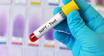 NIPT là xét nghiệm gì