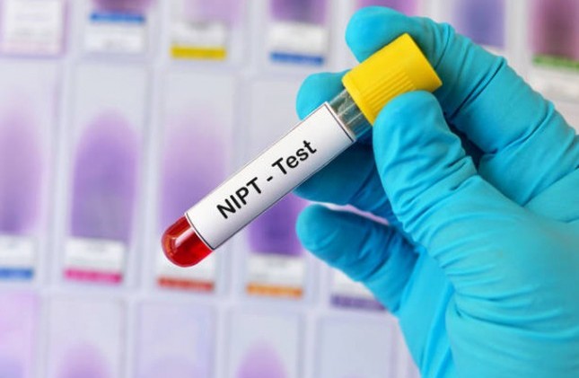 NIPT là xét nghiệm gì
