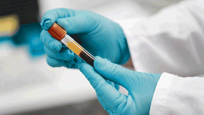 Mẫu máu xét nghiệm ADN ông - cháu