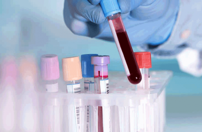 Xét nghiệm ADN bằng máu
