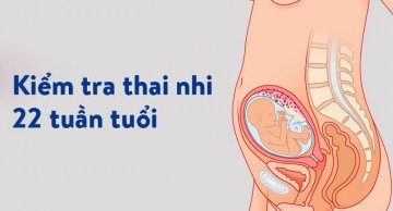 Kiểm tra dị tật thai nhi tuần 22