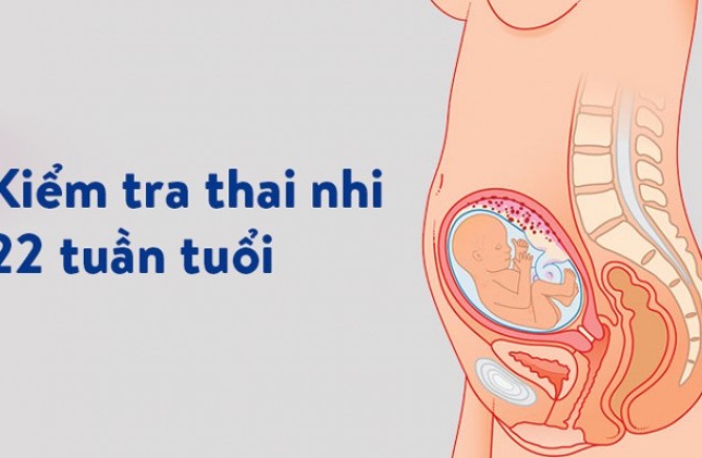 Kiểm tra dị tật thai nhi tuần 22