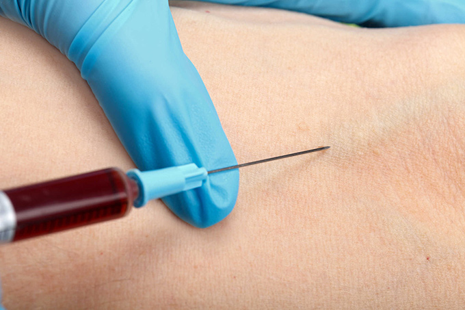 lấy máu xét nghiệm triple test