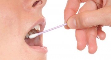 Xét nghiệm ADN bằng niêm mạc miệng
