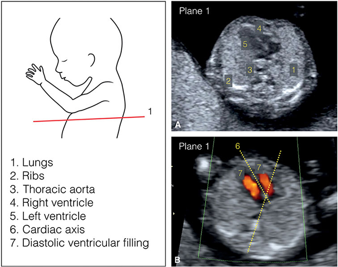 Những mặt cắt trên siêu âm cho phép đánh giá các dị tật bẩm sinh hình thái cơ quan