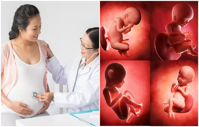 Có các kỹ thuật nào để xác định hội chứng Down ở thai nhi?
