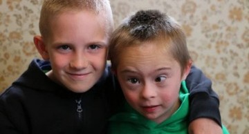 Hai anh em chung huyết thống cách nhau 2 tuổi nhưng người em mắc hội chứng Down do không sàng lọc trước sinh