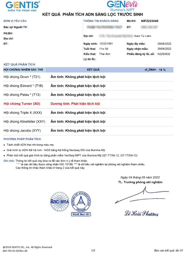 Chỉ số sàng lọc trước sinh an toàn