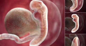 Dị tật thai nhi trong 3 tháng đầu