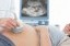 Siêu âm có phát hiện dị tật thai nhi