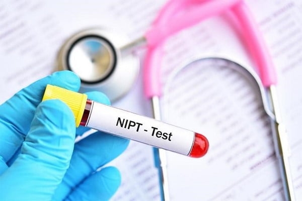 Có cần chuẩn bị gì trước khi thực hiện xét nghiệm NIPT và liệu có đau không?
