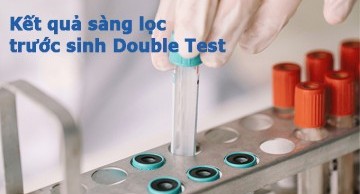 kết quả sàng lọc trước sinh double test