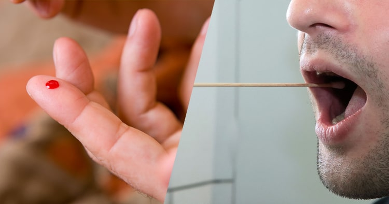 Mẫu máu và mẫu niêm mạc miệng là hai loại mẫu phổ biến trong xét nghiệm ADN anh em cùng cha khác mẹ
