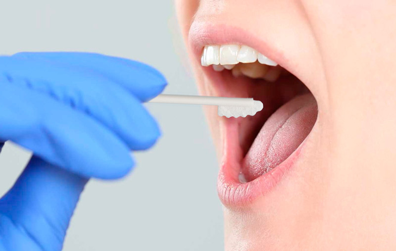 Mẫu tế b&agrave;o ni&ecirc;m mạc miệng l&agrave; một trong những mẫu phổ biến khi x&eacute;t nghiệm ADN chị em ruột