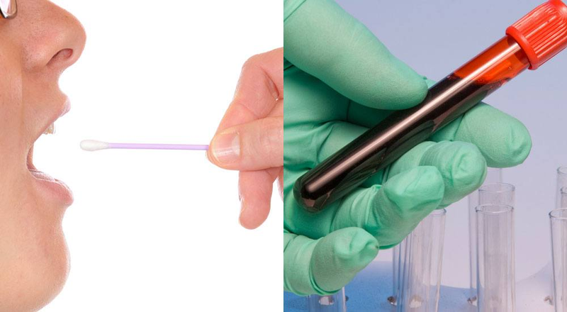 Mẫu m&aacute;u v&agrave; mẫu ni&ecirc;m mạc miệng l&agrave; 2 mẫu phổ biến nhất trong x&eacute;t nghiệm ADN