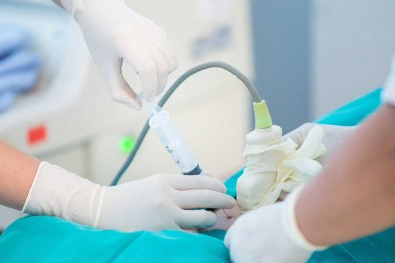 Sinh thiết gai nhau l&agrave; phương ph&aacute;p x&eacute;t nghiệm ADN cho kết quả ch&iacute;nh x&aacute;c tương đối cao