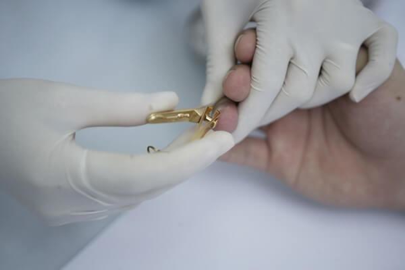 Bạn c&oacute; thể tự thu mẫu x&eacute;t nghiệm ADN tại nh&agrave; hoặc nhờ nh&acirc;n vi&ecirc;n trung t&acirc;m gi&uacute;p đỡ.